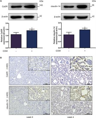 Calcium sensing receptor regulate claudin-14 via PKA-STAT3 pathway in rat model of nephrolithiasis